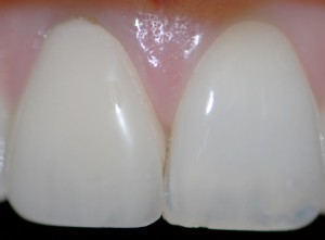 protesi dentale genova